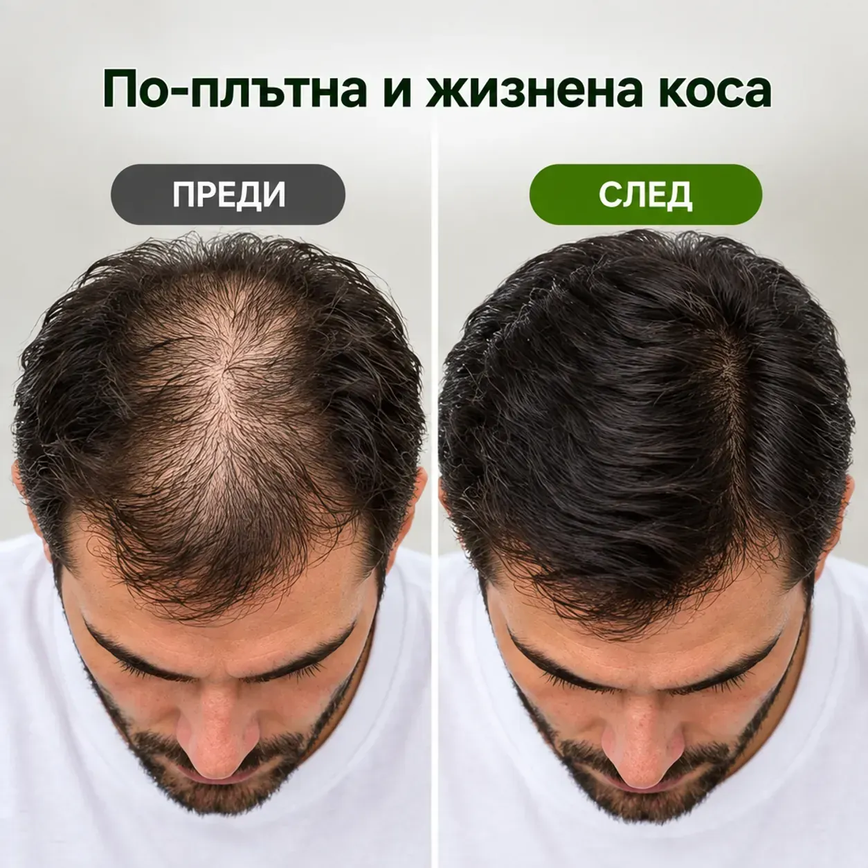 Козметично масло с джинджифил за коса и скалп, Disaar Hair Essential Oil, грижа за корените, 30 г фото 2